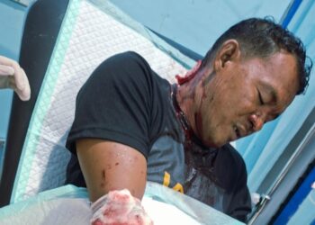 Bonceng Teman Pulang dari Kafe, Pemuda di Kapuas Hulu Disabet Sajam dan Motor R15 Raib