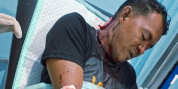 Bonceng Teman Pulang dari Kafe, Pemuda di Kapuas Hulu Disabet Sajam dan Motor R15 Raib